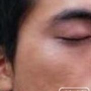 癫痫患者大发作时如何处理